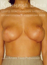���������� ����� || ����� ������������ ��������