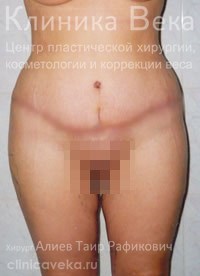 ���������������� - ��������� ����� ������  || ����� ������������ ��������
