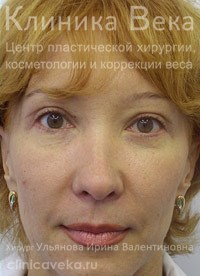 �������� ��� - ���������������  || ����� ������������ ��������