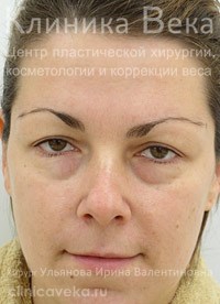 �������� ��� - ���������������  || �� ������������ ��������