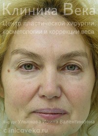 �������� ��� - ���������������  || �� ������������ ��������