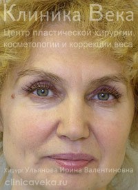 �������� ��� - ���������������  || ����� ������������ ��������