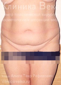 ���������������� - ��������� ����� ������  || �� ������������ ��������