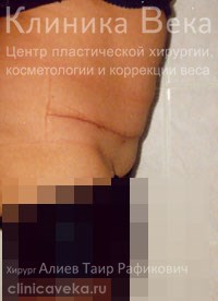 ���������������� - ��������� ����� ������  || ����� ������������ ��������