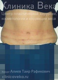 ���������������� - ��������� ����� ������  || ����� 1 ��� ����� ������������ ��������