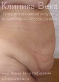 ���������������� - ��������� ����� ������  || �� ������������ ��������