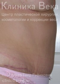 ���������������� - ��������� ����� ������  || ����� ������������ ��������