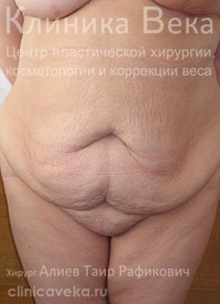 ���������������� - ��������� ����� ������  || �� ������������ ��������